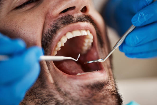 Best Emergency Dental Care  in Mendon, IL